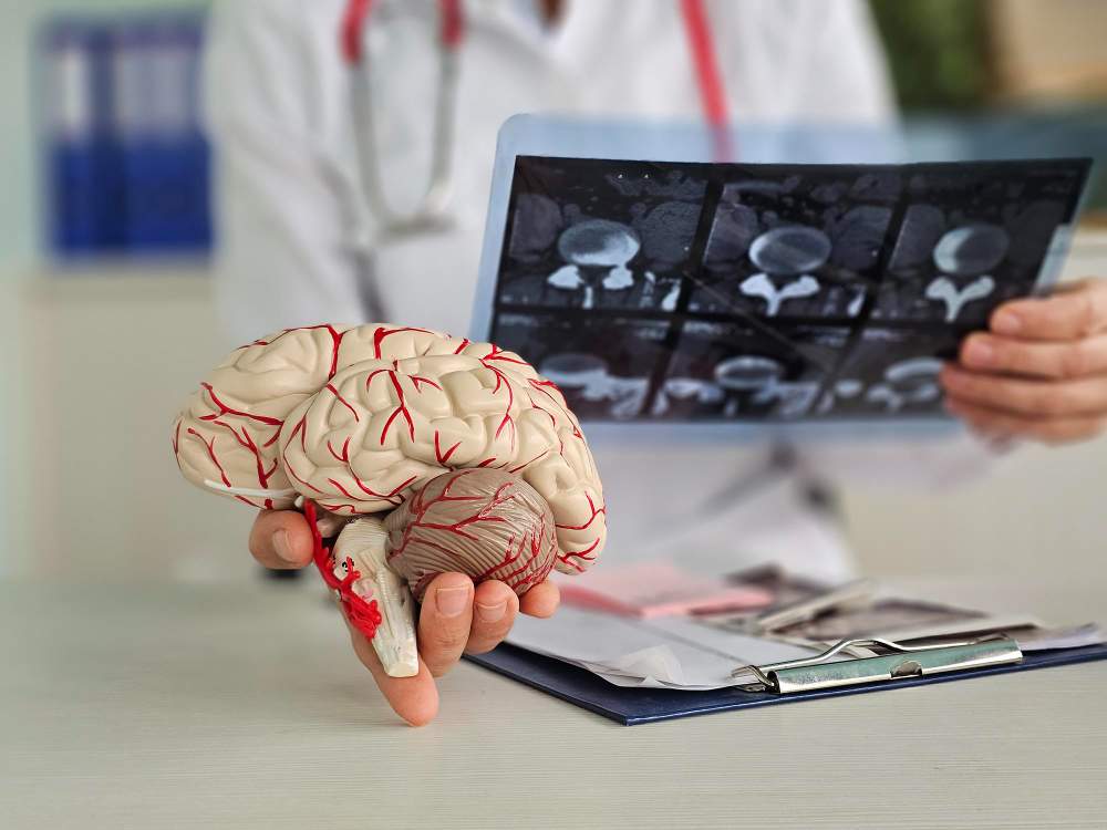 best neurology hospital in hyderabad