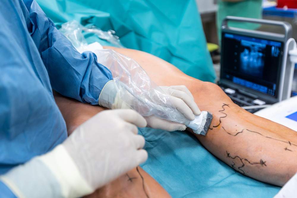vascular operations